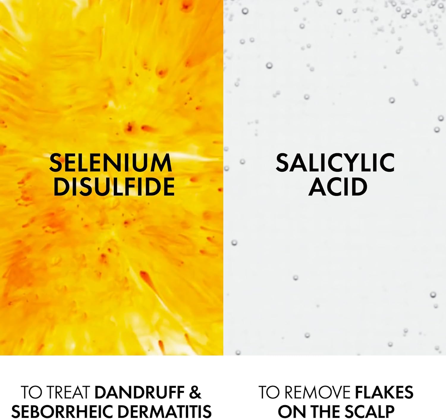 شامبو ديركوس المضاد للقشرة للشعر الجاف علاج فروة الرأس وتنقية عميقة فيشي (200مل)