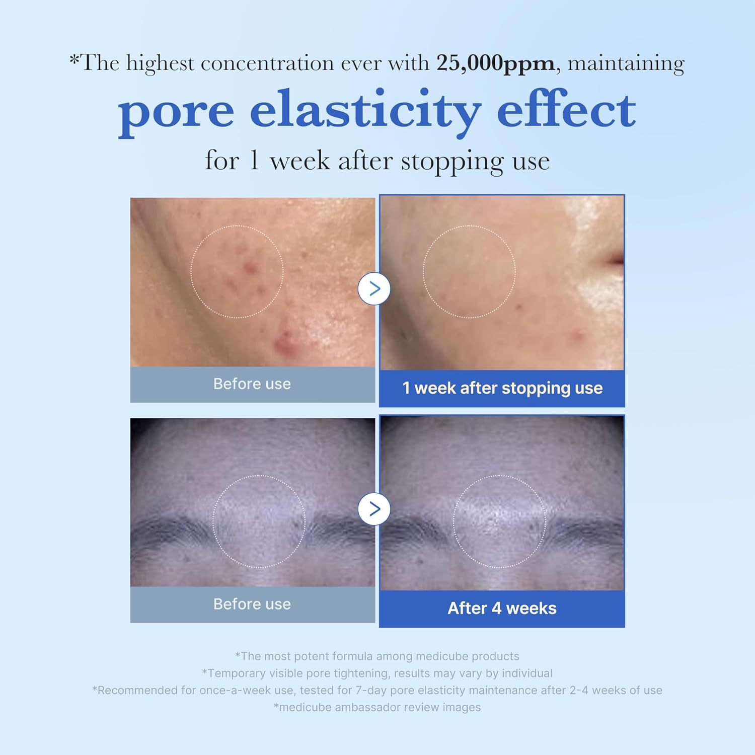 أمبولة إكسوسوم شوت 25000 ليوم واحد من ميديكيوب – 13مل