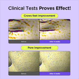 كريم ويشتريند الليلي لتحسين ملمس البشرة والمسام