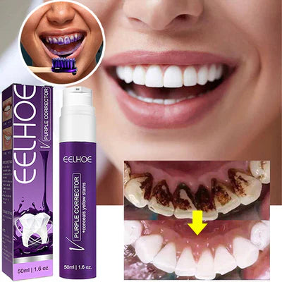 Elho Whitening Toothpaste for Yellow Stains Removal - 50ml
