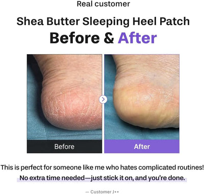 لصقة BAREN Shea Butter Sleeping Heel Patch على الكعب